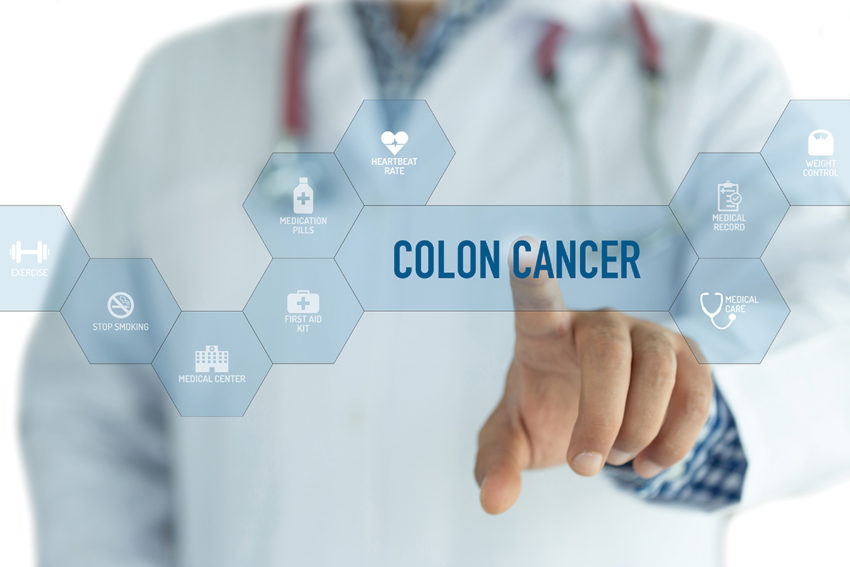 colorectal-cancer-risk-outcomes-tweetchat