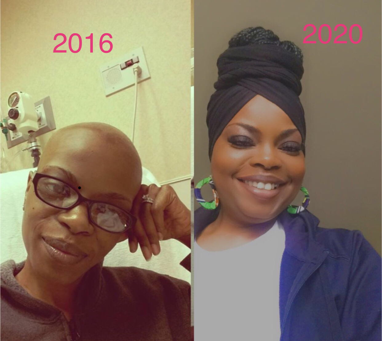 Mimi Frazier White before and after cancer