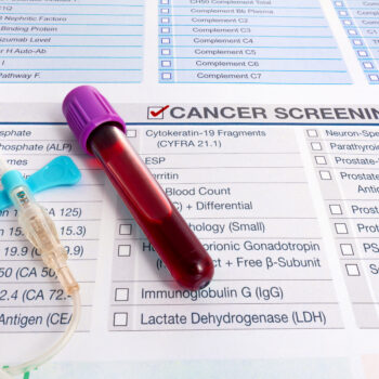 Blood test sample for Tumor markers test for diagnosis cancer
