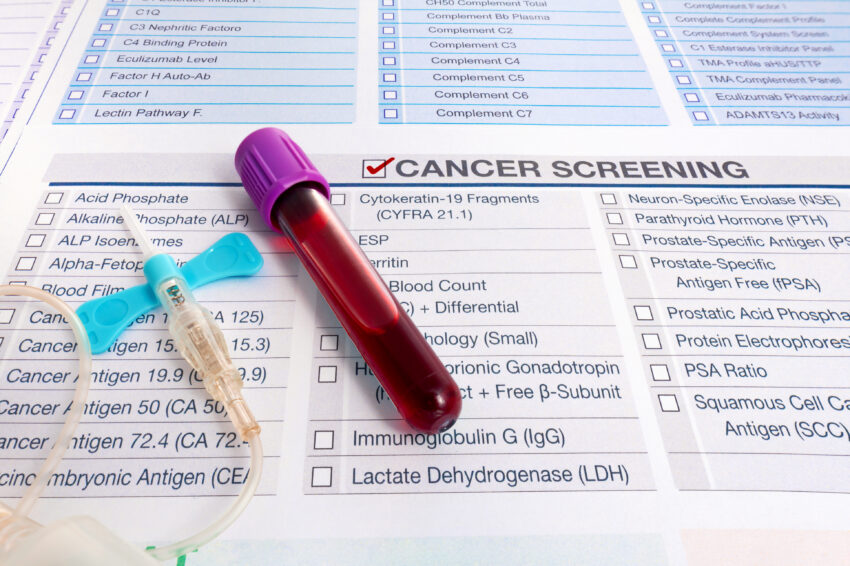 Blood test sample for Tumor markers test for diagnosis cancer