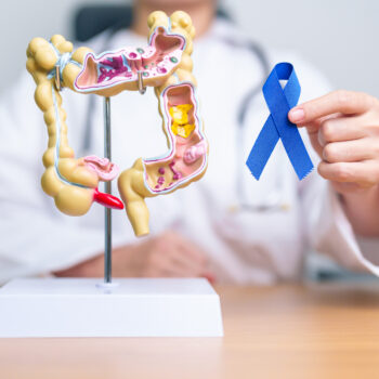 Doctor holding Blue ribbon with human Colon anatomy model. March Colorectal Cancer Awareness month, Colonic disease, Large Intestine, Ulcerative colitis, Digestive system and Health concept