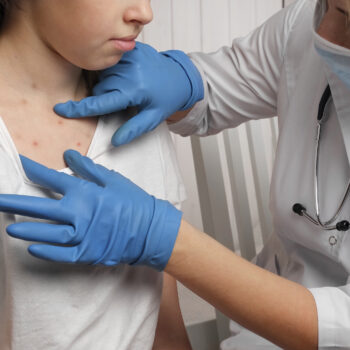 Doctor Checking Skin of Sick Girl. Kid with Red Rash being Examined at the Physician. Allergic Rash, Chicken pox, Monkeypox Symptoms on the Body of Child. Health Problem. Bacterial Infections, Disease